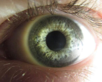 7 hábitos que você precisa mudar para proteger seus olhos