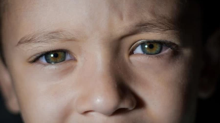 Outono pode agravar sintomas de alergias oculares em crianças